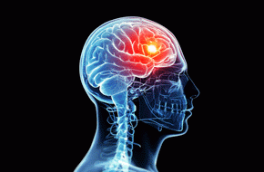 Dave Grimmond suspects the RBNZ will get 'an almighty headache' with their new LVR policy. <a href="http://www.shutterstock.com/">Image sourced from Shutterstock.com</a>